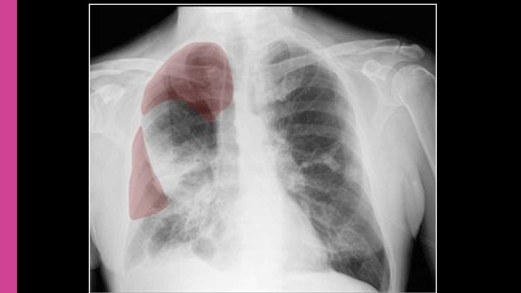 4 Ways Artificial Intelligence is Poised to Transform Medicine