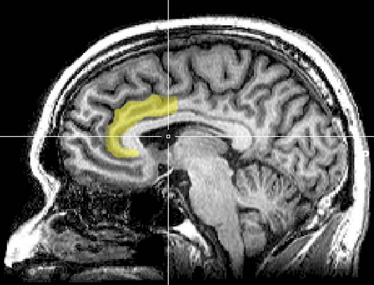 acc-consciousness-neurosciencenews
